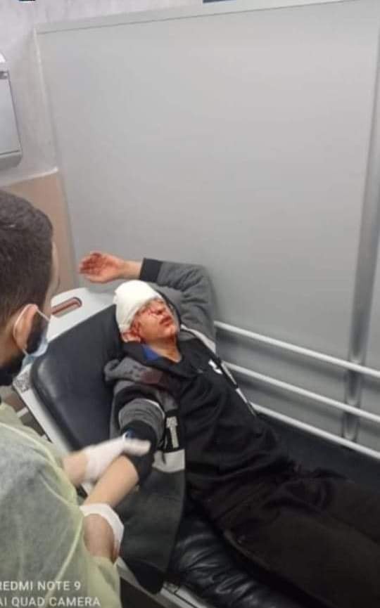 إصابة شاب بالرصاص المطاطي بالرأس خلال مواجهات رام الله